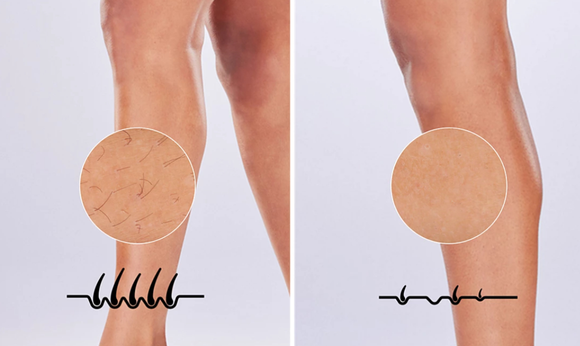 Pelle liscia senza stress comodamente a casa